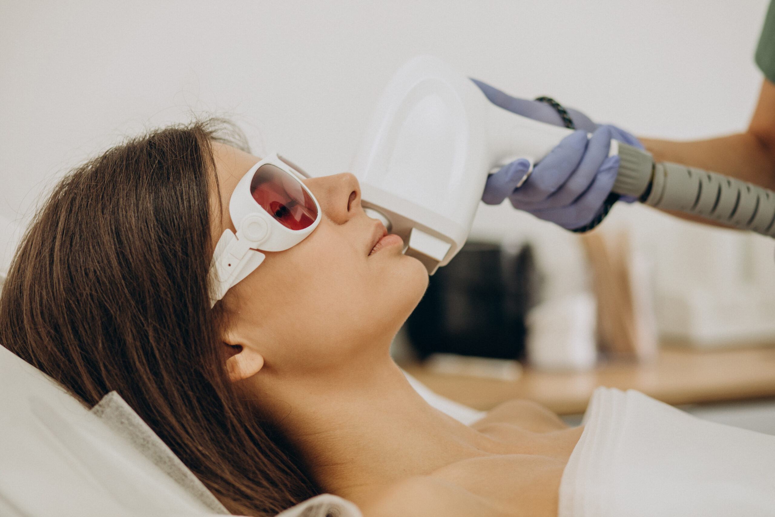 laser hair removal face